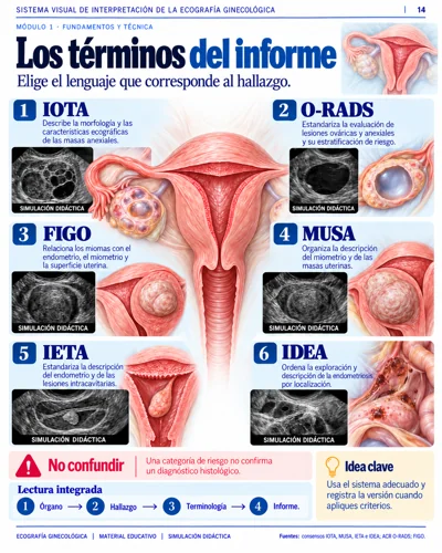 Vista previa de Los términos del informe