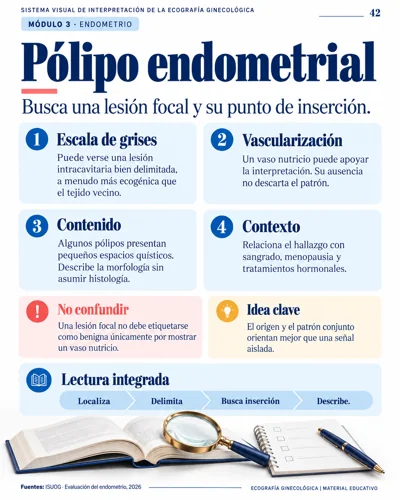 Pólipo endometrial